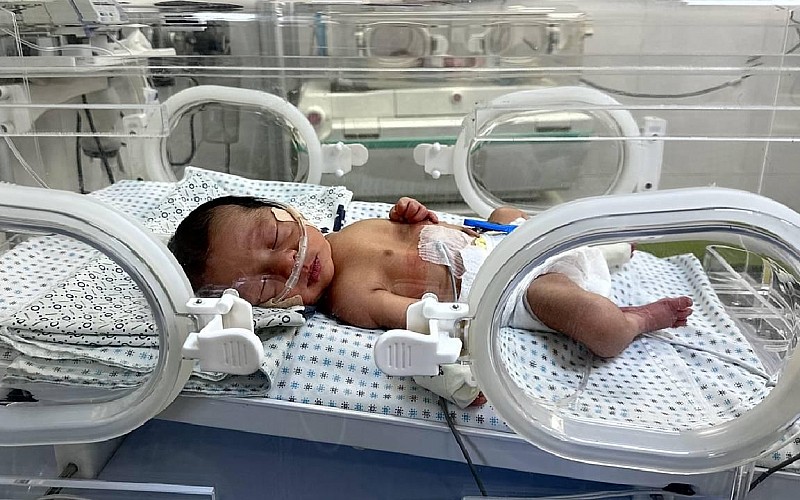DSÖ: Gazze'de 15 bin 600'den fazla kişi tıbbi tahliyeye ihtiyaç duyuyor DSÖ: Gazze'de 15 bin 600'den fazla kişi tıbbi tahliyeye ihtiyaç duyuyor